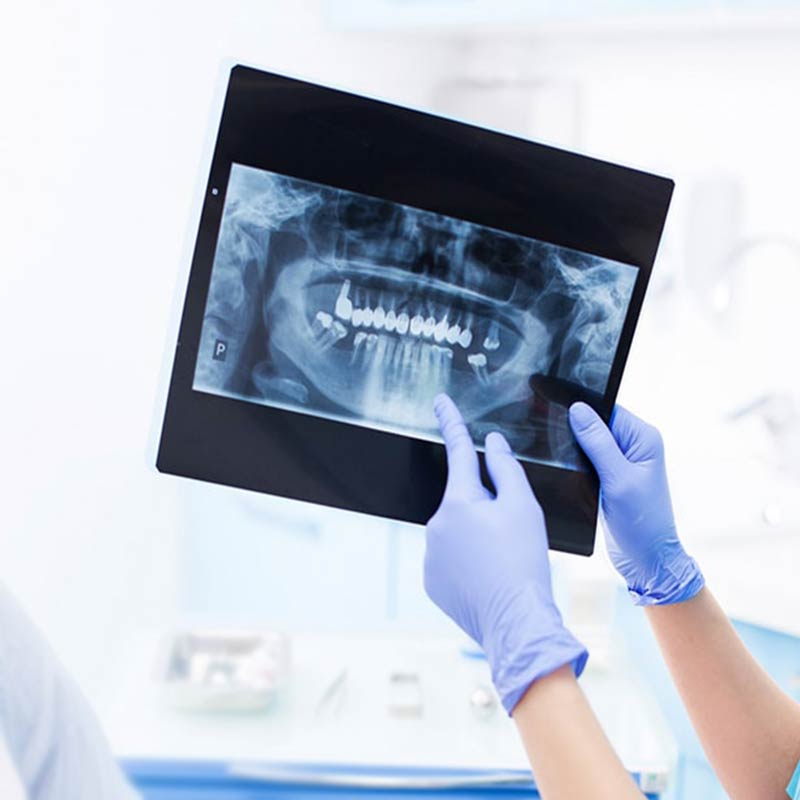 Radiografia Odontoiatrica